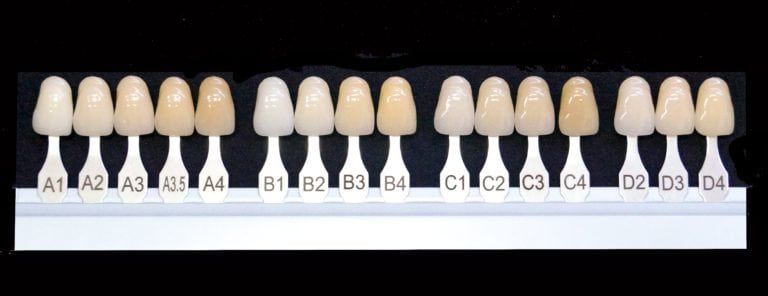 An assortment of fake teeth showing different teeth colors and shades