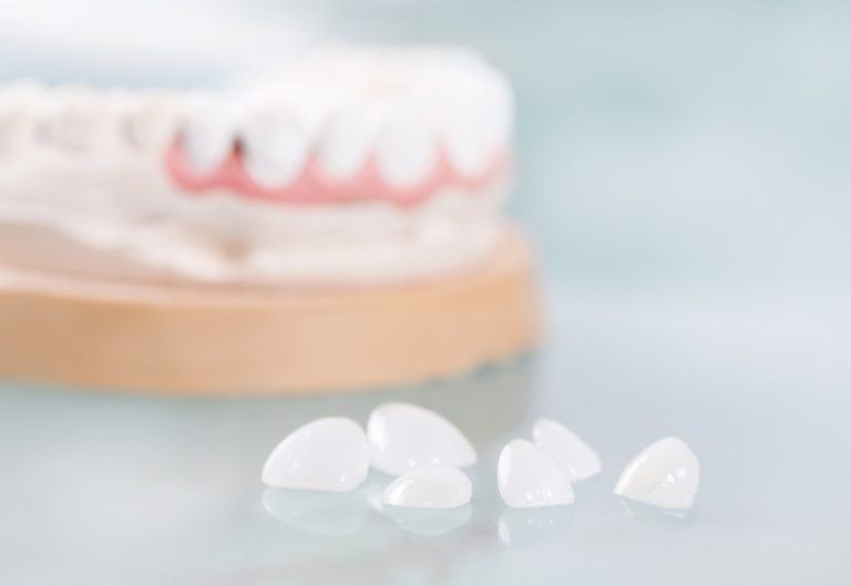 porcelain veneers on a plain background
