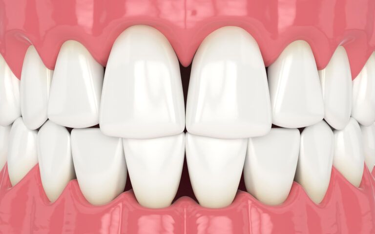 Dental Triangles Vector